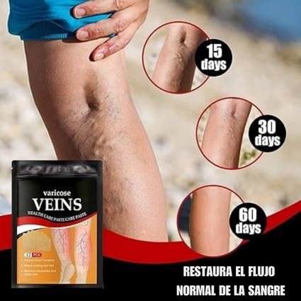 PACK DE PARCHES PARA VENAS VARICES X12