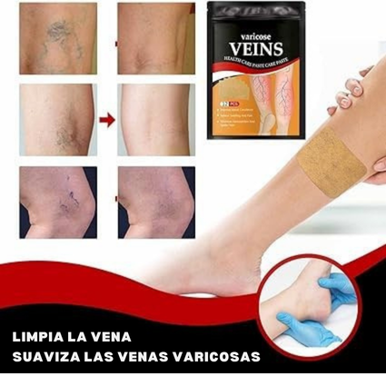 PACK DE PARCHES PARA VENAS VARICES X12