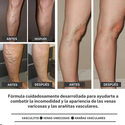 PACK DE PARCHES PARA VENAS VARICES X12