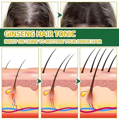 Ouhoe Tonico Capilar para la caída del cabello