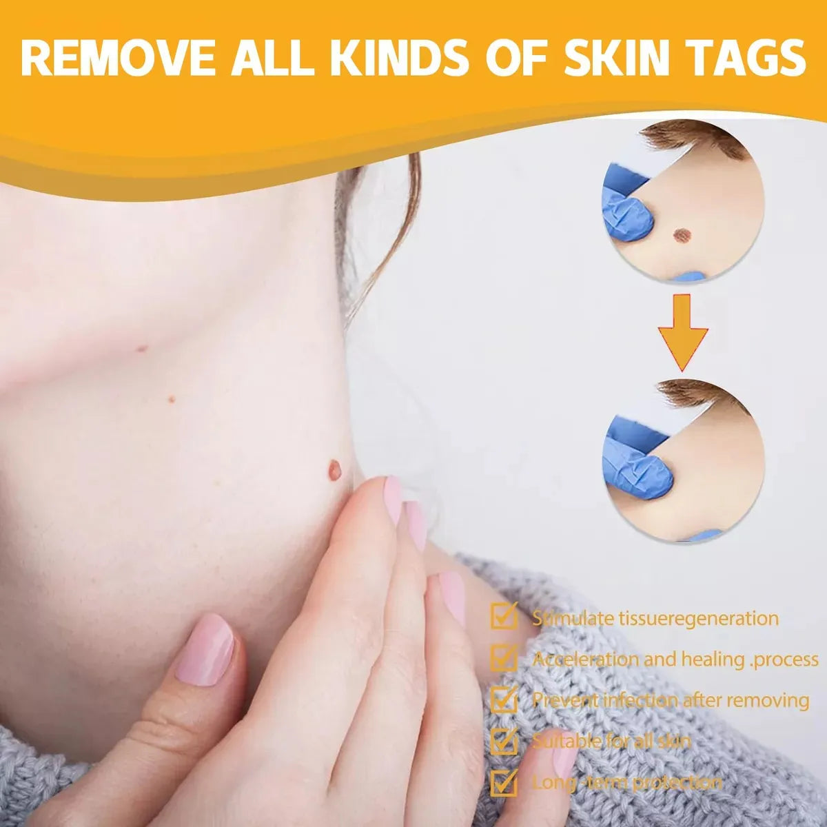 Tag Recede - Spray Eliminador de verrugas