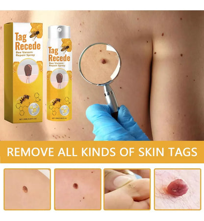 Tag Recede - Spray Eliminador de verrugas