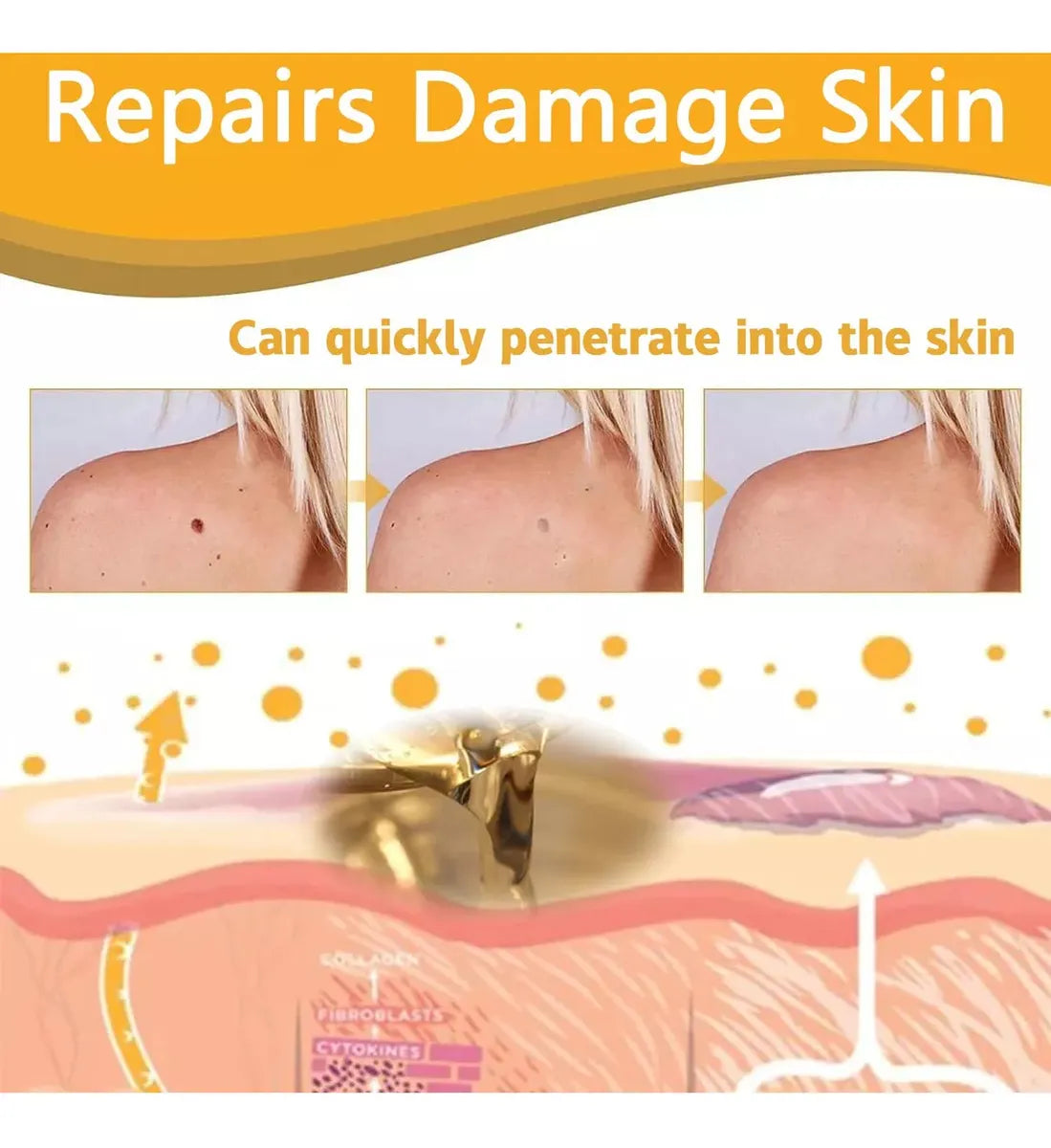 Tag Recede - Spray Eliminador de verrugas